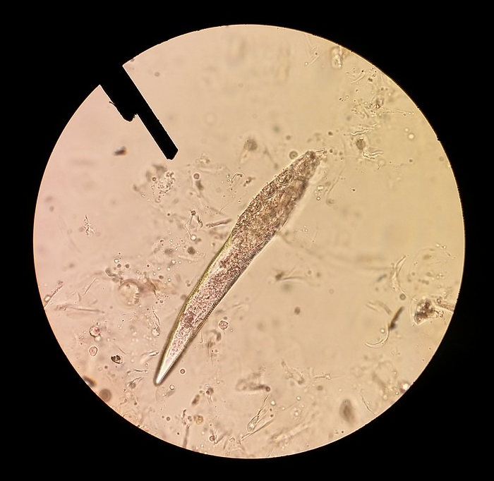 microbiom, piele, demodex, microscop